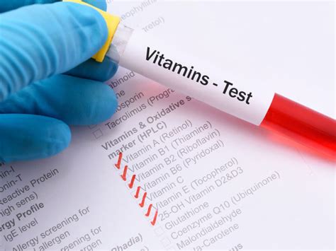 vitamin and mineral testing near me